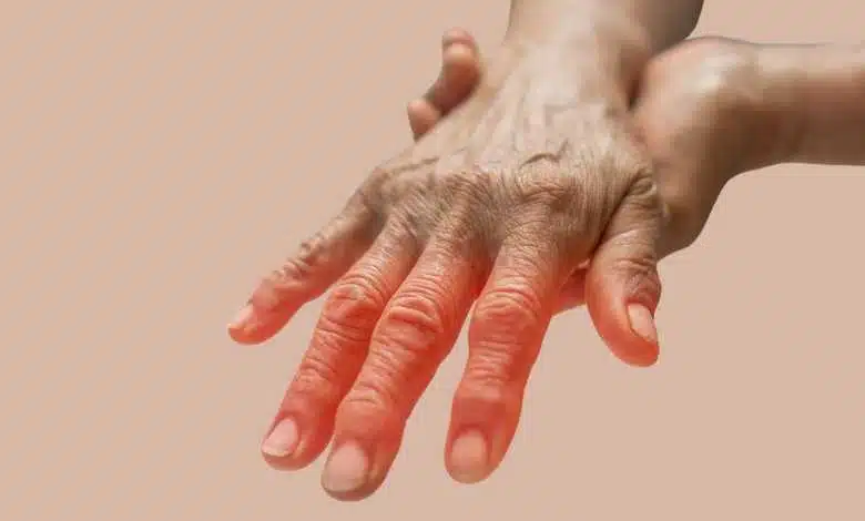 Relieve Nerve Pain Naturally 